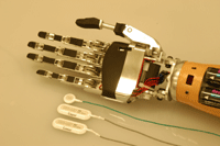 筋電制御義手、ロボットハンド